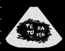te/ra/to/ma